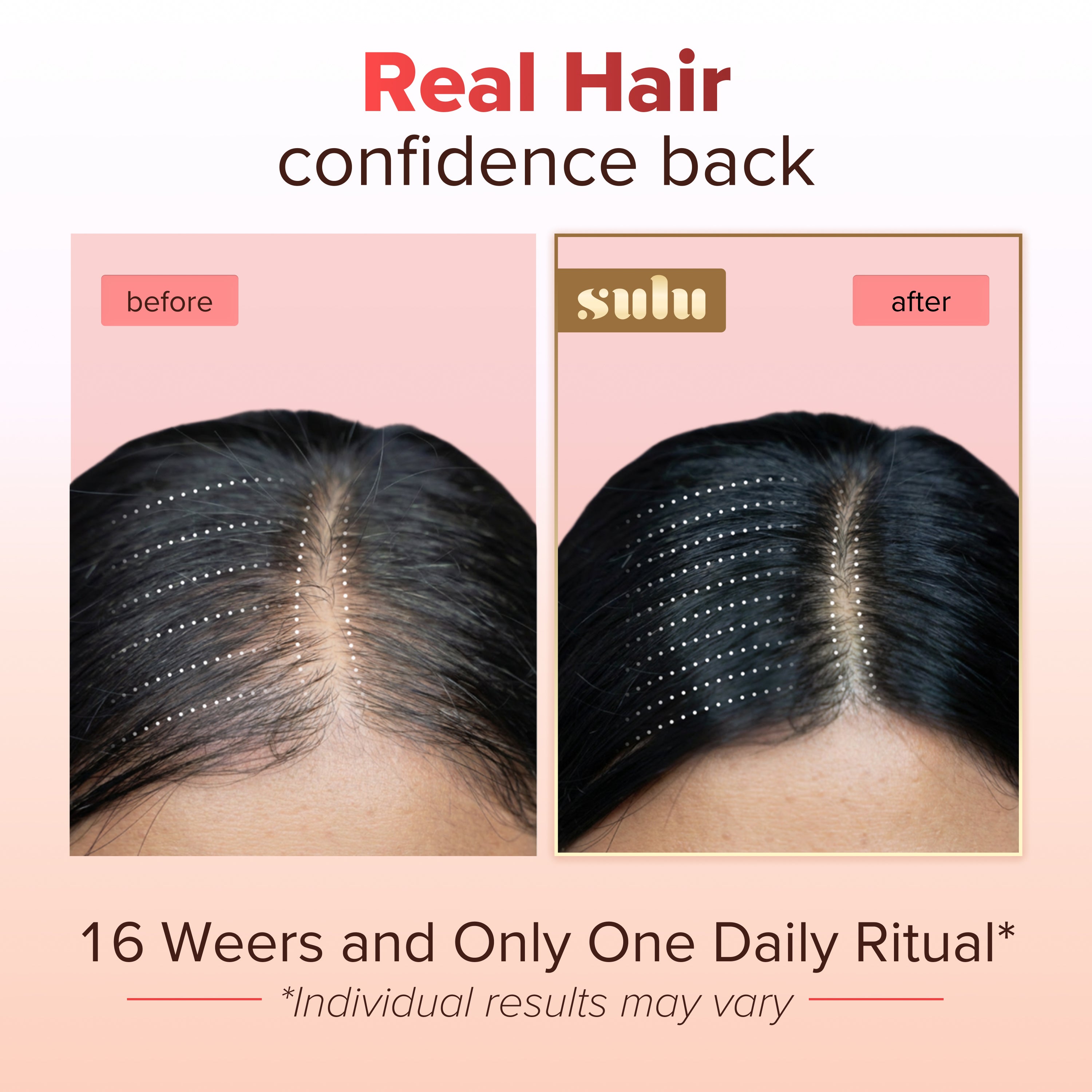 Hair Growth Gummies