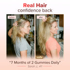 Hair Growth Gummies